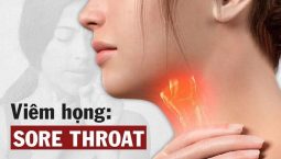 Viêm họng là gì? Các dạng viêm họng và phương pháp điều trị dứt điểm nhờ vật lý trị liệu