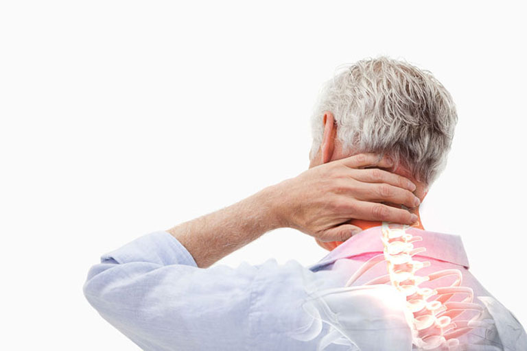 Thoái hóa khớp cổ thường gây ra những cơn đau kéo dài, lan rộng khắp vùng cổ vai gáy
