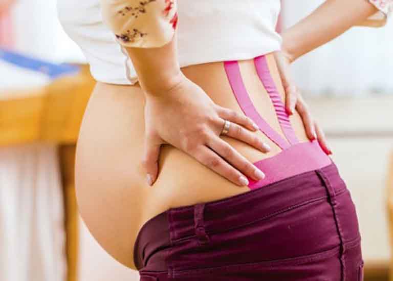 Căng cơ lưng là nguyên nhân chính gây ra đau lưng mệt mỏi trong thai kỳ