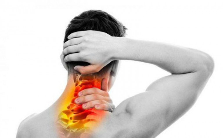 Thoát vi đĩa đệm cổ là nguyên nhân dẫn đến đau cổ thường xuyên ở người bệnh