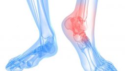 Thoái hóa khớp cổ chân là gì? Nguyên nhân, biểu hiện và cách điều trị