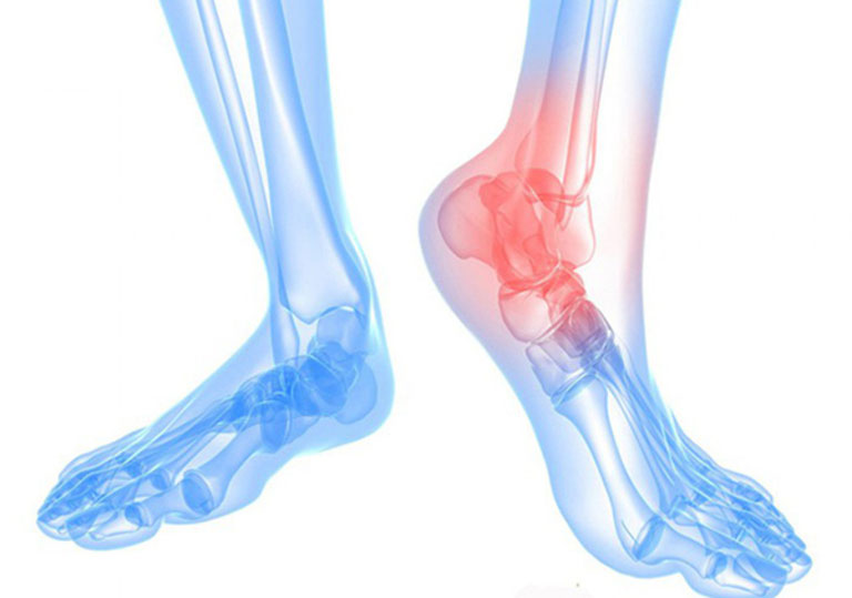 Bấm huyệt trị đau nhức chân cần được thực hiện bởi các thầy thuốc có chuyên môn