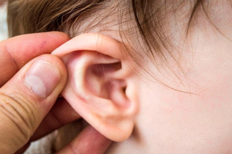 Viêm tai giữa là nguyên nhân chính dẫn đến liệt dây thần kinh số 7