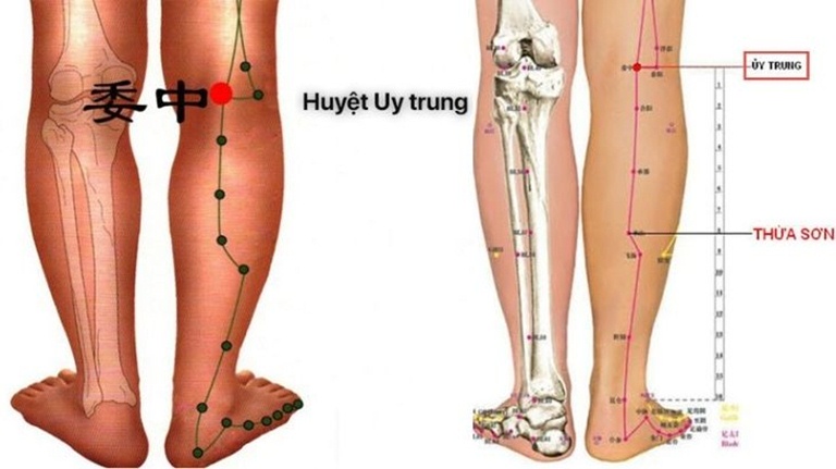 Huyệt Ủy trung giúp giảm tê chân, điều trị viêm khớp gối