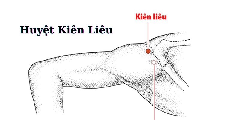 Kiên Liêu là huyệt thứ 13 thuộc Tam Tiêu Kinh, là huyệt cuối cùng thuộc vùng xương vai, có vị trí tại chỗ hõm xương.