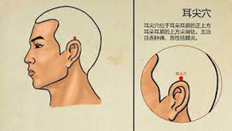 Huyệt Nhĩ Tiêm nằm ở đỉnh của vành tai