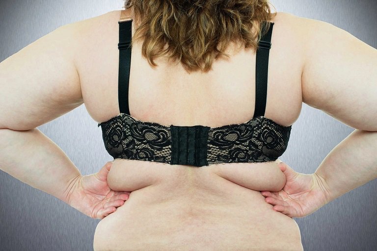 Mỡ lưng hình thành chủ yếu do chế độ ăn uống thiếu lành mạnh và thói quen lười vận động