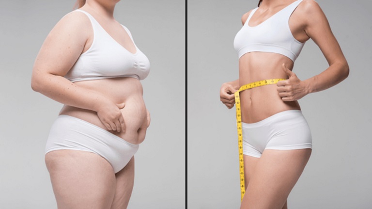 Giảm mỡ toàn thân là việc giảm chất béo - mỡ thừa trong cơ thể