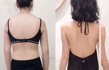 Cách giảm mỡ lưng cho nữ hiệu quả chỉ sau 7 ngày