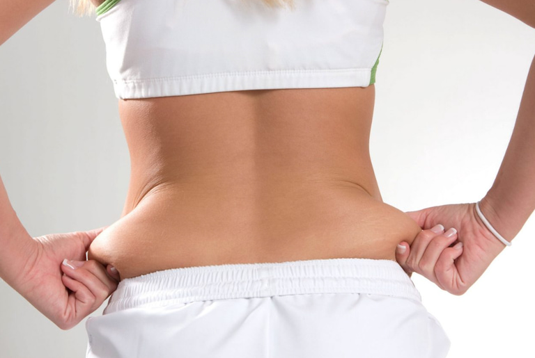 Mỡ toàn thân là một thuật ngữ sử dụng để chỉ mỡ tích tụ trên khắp cơ thể
