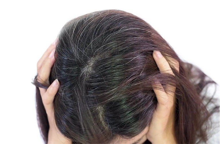 Bấm huyệt chữa tóc bạc vừa hiệu quả lại không gây tác dụng phụ