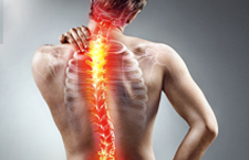 Đau nhức xương sống lưng: Nguyên nhân và Cách điều trị