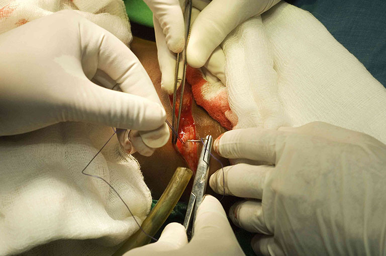 Phẫu thuật giúp bạn thoát khỏi căn bệnh thoát vị đĩa đệm cột sống cổ
