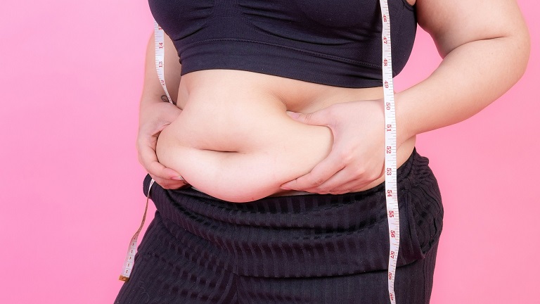 Béo phì độ 1 là mức độ nhẹ nhất của bệnh béo phì