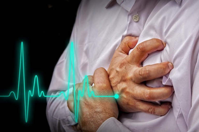 Xơ vữa động mạch gây ra những cơn đau tim, nhồi máu cơ tim