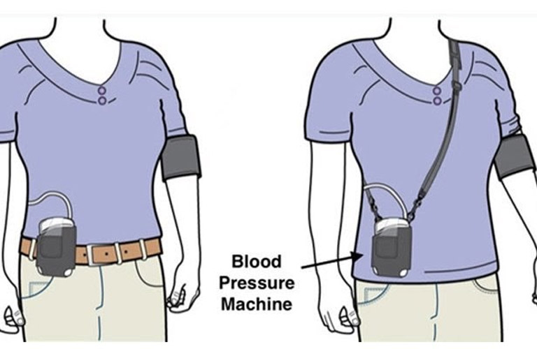 Holter huyết áp là phương pháp kiểm tra áp lực máu liên tục
